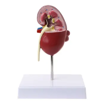 Gyvenimo Dydžio Žmonių Sergančių Inkstų Anatomijos Modelis Anatomija Ligonių Patologinių Akmens Organų Mokymo Reikmenys 634B