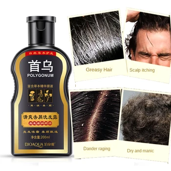 200 ml-Polygonum multiflorum juodų plaukų šampūnas Gleditsia natūralūs šampūnai, plaukų priežiūra, remontas, alyvos kontrolės anti-pleiskanų kremas