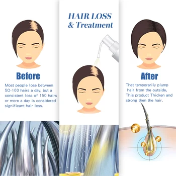 Plaukų Slinkimas Gydymo Vyrai/Moterys Augalų plaukų slinkimo Plaukų Augimą Skysčio Natūralių Augalų Sudedamųjų dalių Plaukai Atauga Priežiūros Produktas