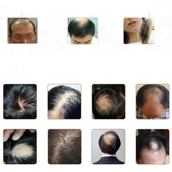 Imbieras Plaukų Augimo Esmė 7 Dienas Germinaciniai Plaukų Augimo Serumas Esmė Aliejus, Plaukų Slinkimas Gydymo Augimo Plaukų Vyrams, Moterims