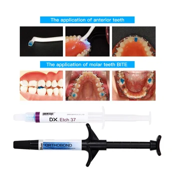 Dantų Šviesa Išgydyti Ortodontinis Klijų Rinkinys, skirtas Atidaryti Bite & Orto Juostos Klijavimas